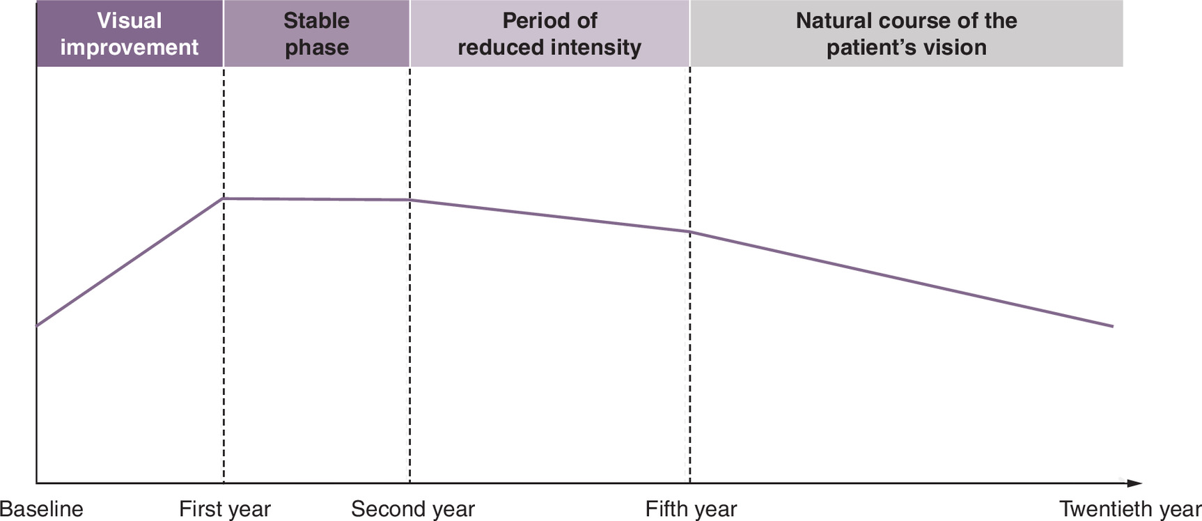 A diagram showing an overview of three-phase treatment stages for patients with DME, including an extended loading phase in the first year, stabilized disease progression in the second year, and gradual decline in treatment intensity from the third year onwards.