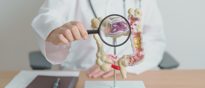 Doctor holding a magnifying glass over a model of the human colon, highlighting internal structures. To represent a new partnership between Aetion and Crohn’s & Colitis Foundation to enhance real-world IBD research