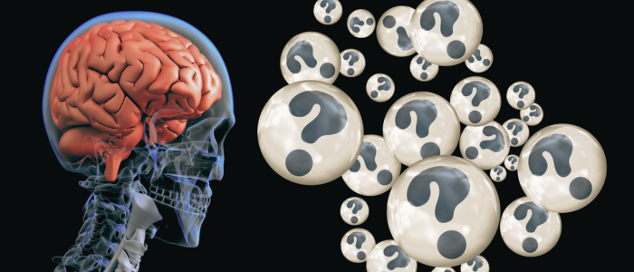 Alzheimer’s brain illustration with question mark spheres representing cognitive decline and data analysis