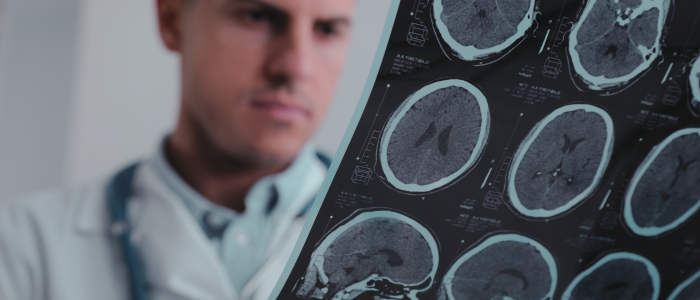 Doctor reviewing MRI brain scan images with a blurred background.