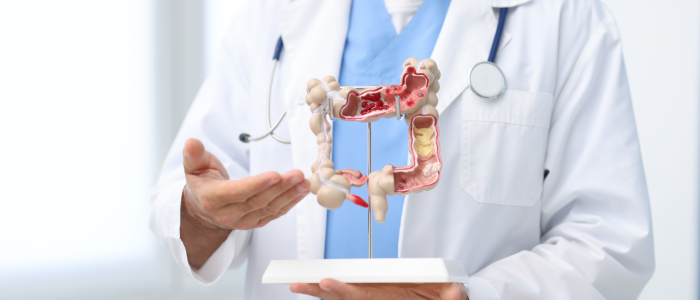 Doctor with stethoscope holds an anatomical model of the colon and gestures toward the gastrointestinal tract.